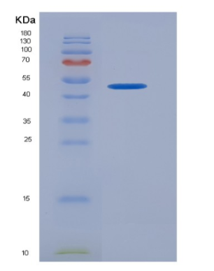 Recombinant Human KIR2DL1 / CD158a Protein (Fc tag),Recombinant Human KIR2DL1 / CD158a Protein (Fc tag)