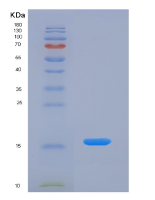 Eukaryotic Agouti Related Protein (AGRP),Eukaryotic Agouti Related Protein (AGRP)