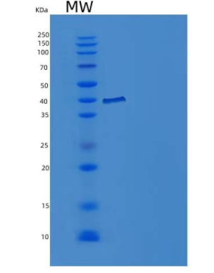 Recombinant Human IL-1R8 / IL1RAPL1 Protein (His tag),Recombinant Human IL-1R8 / IL1RAPL1 Protein (His tag)