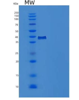 Recombinant Human PDE9A Protein (His tag),Recombinant Human PDE9A Protein (His tag)