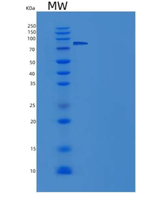 Recombinant Human SGK3 / SGKL Protein (His & GST tag),Recombinant Human SGK3 / SGKL Protein (His & GST tag)