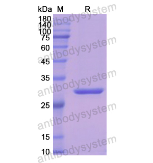 重组HMBS蛋白,Recombinant Human HMBS, N-His