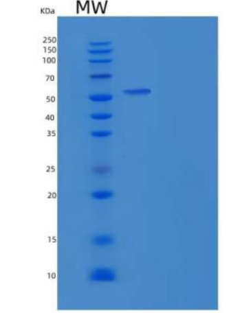 Recombinant Human AIM2 Protein (GST tag),Recombinant Human AIM2 Protein (GST tag)