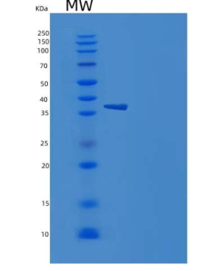 Recombinant Human NETO1 / BTCL1 Protein (His tag),Recombinant Human NETO1 / BTCL1 Protein (His tag)