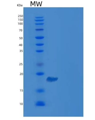 Recombinant Human CDC42BPB Protein (His & GST tag),Recombinant Human CDC42BPB Protein (His & GST tag)