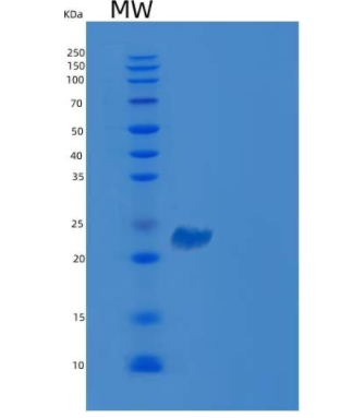 Recombinant Human VSIG2 Protein (His Tag),Recombinant Human VSIG2 Protein (His Tag)