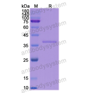 重組CD14蛋白,Recombinant Human CD14, N-His