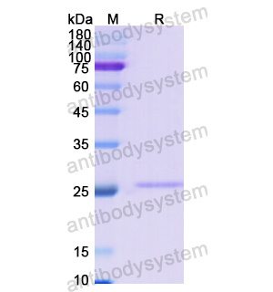 重组COL4A2蛋白,Recombinant Human COL4A2, N-His