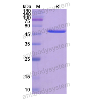 重组CD45/PTPRC蛋白,Recombinant Human CD45/PTPRC, N-His