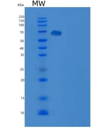 Recombinant Human Tie2 / CD202b / TEK Protein (His & GST tag),Recombinant Human Tie2 / CD202b / TEK Protein (His & GST tag)