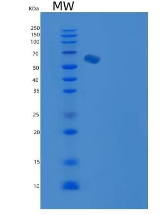 Recombinant Human Endoglin / CD105 / ENG Protein (His tag),Recombinant Human Endoglin / CD105 / ENG Protein (His tag)