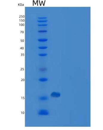 Recombinant Human PMP2 / FABP8 Protein (His tag),Recombinant Human PMP2 / FABP8 Protein (His tag)
