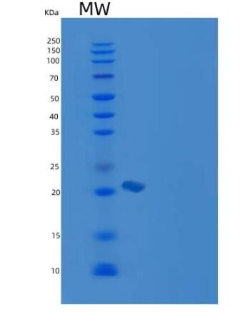 Recombinant Mouse CD2 / LY37 Protein (His tag),Recombinant Mouse CD2 / LY37 Protein (His tag)