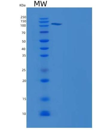 Recombinant Human Neuropilin 2 / NRP2 Protein (Fc tag),Recombinant Human Neuropilin 2 / NRP2 Protein (Fc tag)