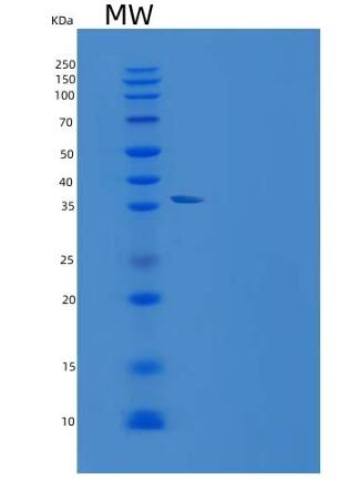 Recombinant Human Resistin / ADSF / RETN Protein (Fc Tag),Recombinant Human Resistin / ADSF / RETN Protein (Fc Tag)