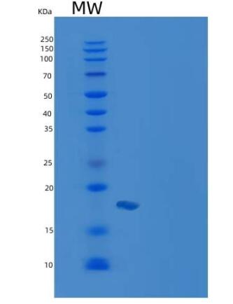 Recombinant Mouse CRABP2 / CRABPII Protein (His tag),Recombinant Mouse CRABP2 / CRABPII Protein (His tag)