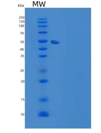 Recombinant Human TERF1 / TRF1 Protein (His tag),Recombinant Human TERF1 / TRF1 Protein (His tag)