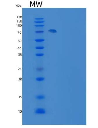 Recombinant Human MEK2 / MAP2K2 / MKK2 Protein (GST tag),Recombinant Human MEK2 / MAP2K2 / MKK2 Protein (GST tag)