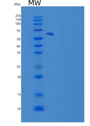 Recombinant Rat GPT2 Protein (His tag),Recombinant Rat GPT2 Protein (His tag)