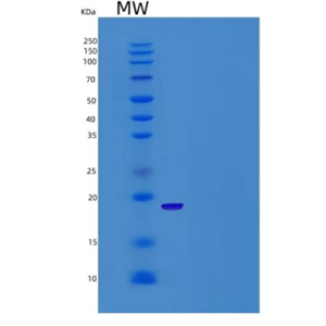 Recombinant Human ALOX5AP / FLAP Protein (His tag)