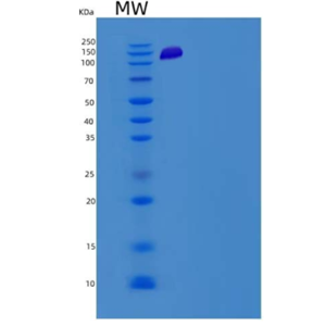 Recombinant Mouse PKC delta / PRKCD Protein (His & GST tag)