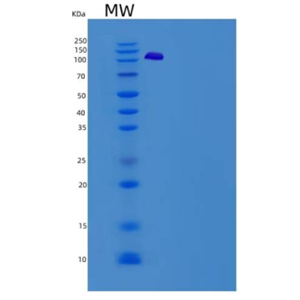 Recombinant Human VCL / Vinculin Protein (His tag),Recombinant Human VCL / Vinculin Protein (His tag)