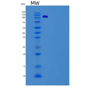 Recombinant Human VCL / Vinculin Protein (His tag)