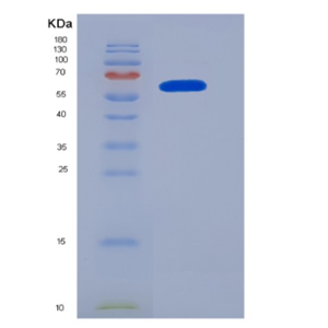 Eukaryotic Neuropilin 1 (NRP1),Eukaryotic Neuropilin 1 (NRP1)