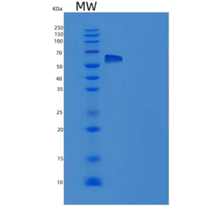 Recombinant Human IL-1R8 / IL1RAPL1 Protein (Fc tag)