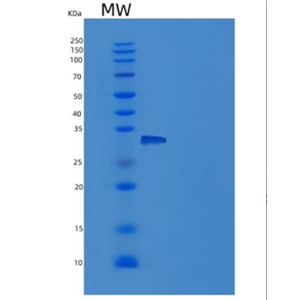 Recombinant Mouse NEGR1 Protein (His tag)