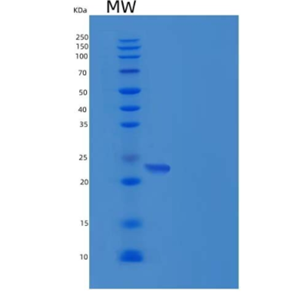 Recombinant Human Layilin / LAYN Protein (His tag)