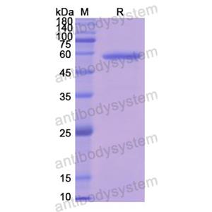 重组CD243/ABCB1蛋白,Recombinant Human CD243/ABCB1, N-GST