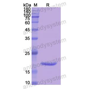 重组SERPINA6蛋白,Recombinant Human SERPINA6, N-His