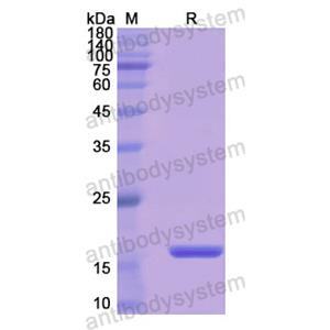 Recombinant Human CD98/SLC3A2, N-His