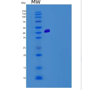 Recombinant Human ADCYAP1R1 Protein (Fc tag)