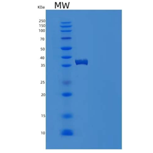 Recombinant Human S100A2 Protein (Fc tag),Recombinant Human S100A2 Protein (Fc tag)