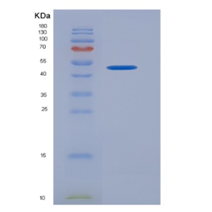 Recombinant Human KIR2DL1 / CD158a Protein (Fc tag)