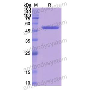 Recombinant Human NR3C2, N-GST