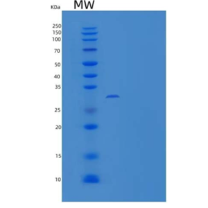 Recombinant Mouse Carbonic Anhydrase XII / Car12 Protein (His tag)