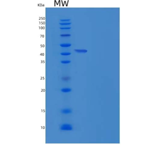 Recombinant Human TMED1 Protein (Fc tag)