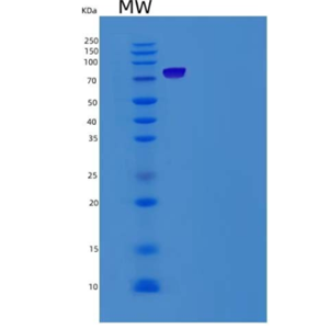 Recombinant Human LRP10 Protein (Fc tag)