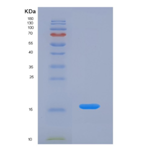 Eukaryotic Agouti Related Protein (AGRP)