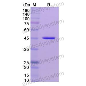 Recombinant Human MMP3, N-His