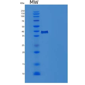 Recombinant Human PDE9A Protein (His tag)