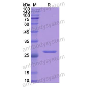 重组GSTA1蛋白,Recombinant Human GSTA1, N-His