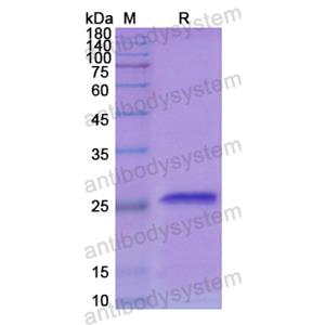 重组SOD3蛋白,Recombinant Human SOD3, N-His