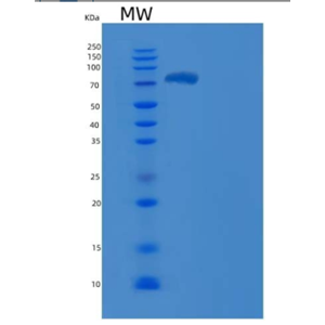 Recombinant Human VRK1 Protein (His & GST tag)