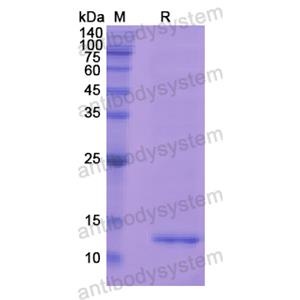 Recombinant Human MGP, N-His