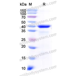 Recombinant Human PDHA1, N-His