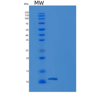 Recombinant Human TFAP2C / AP2-GAMMA Protein (His tag)